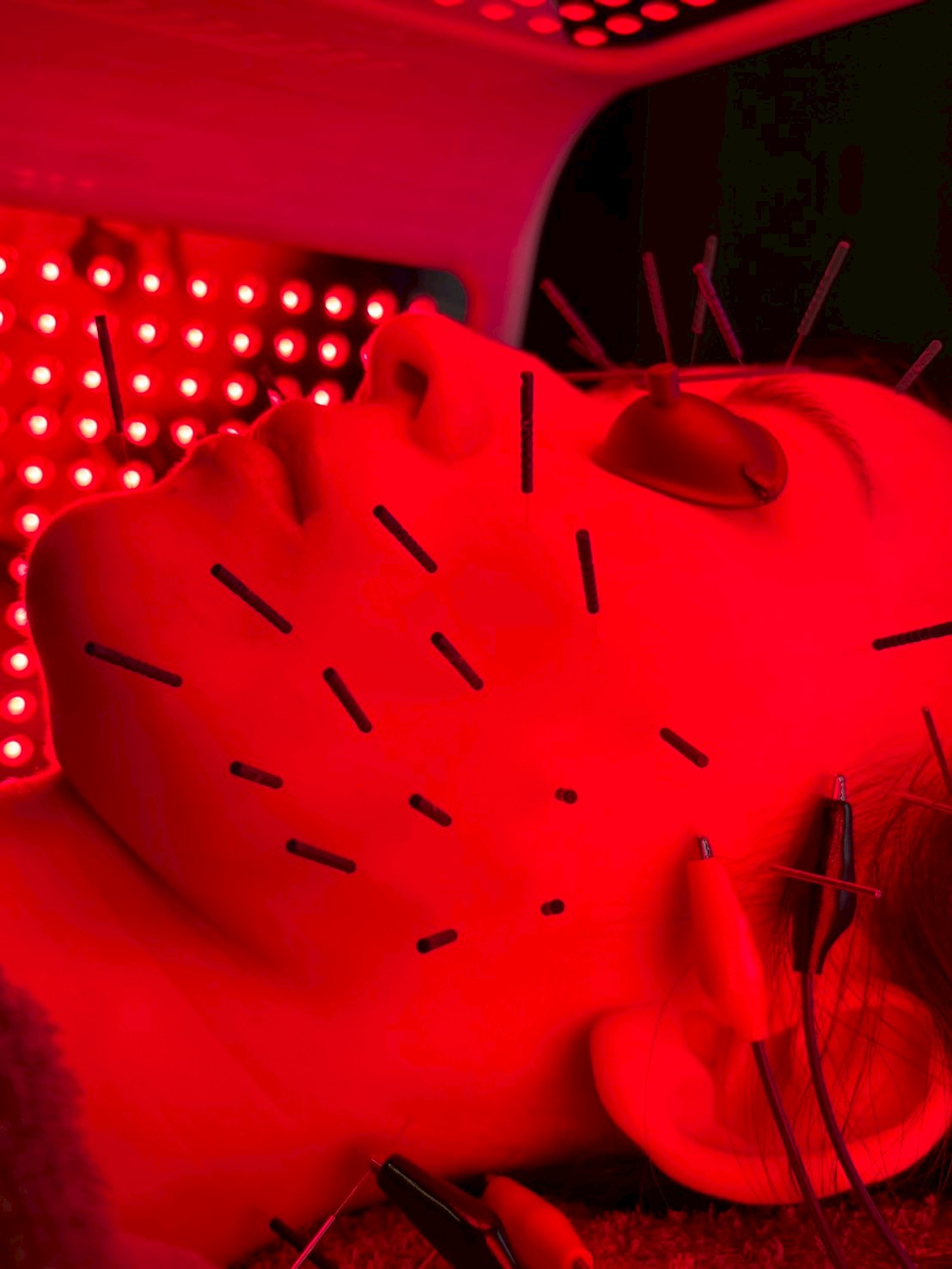 肌質特化 × LED美容鍼 3